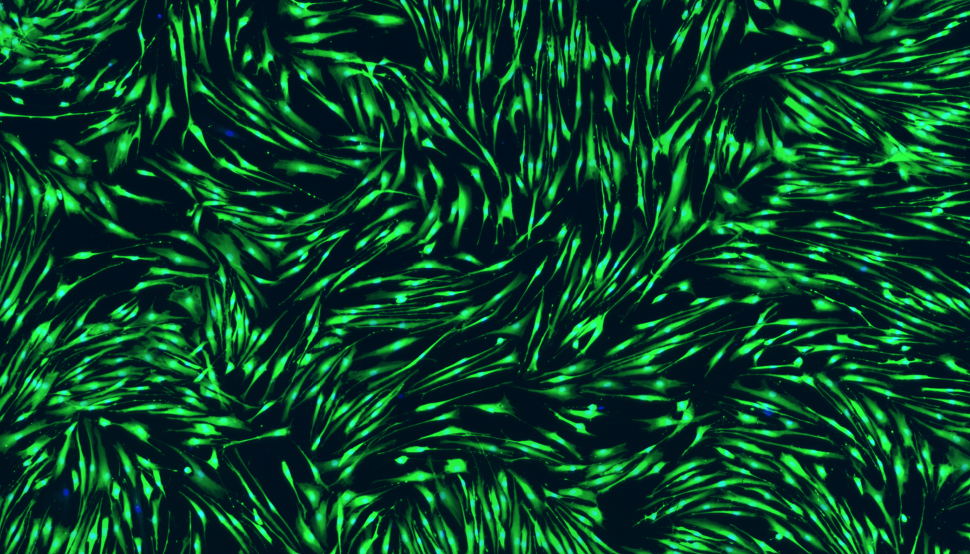 Fibroblast cells stained with Calcein AM (green) and Hoechst (blue)